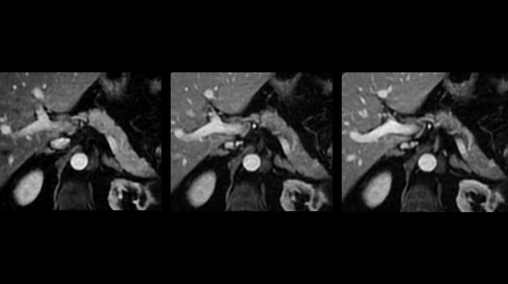 HyperWorks1040-x-585