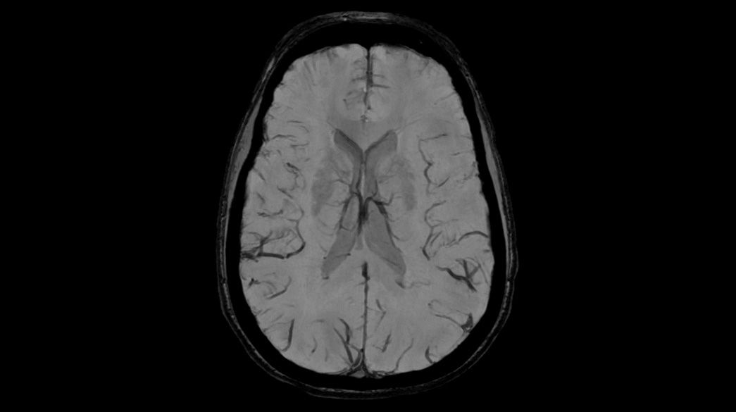 HyperWorks1040-x-585