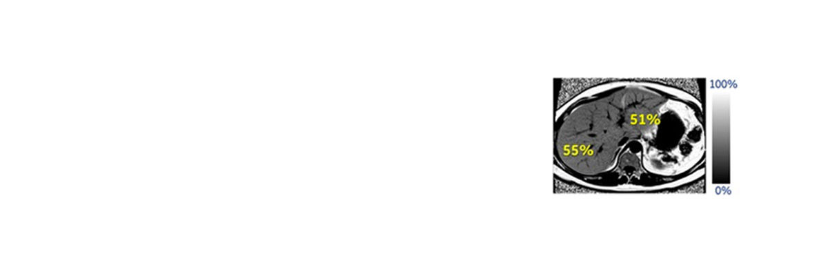 IDEAL-IQ-application-spotlight