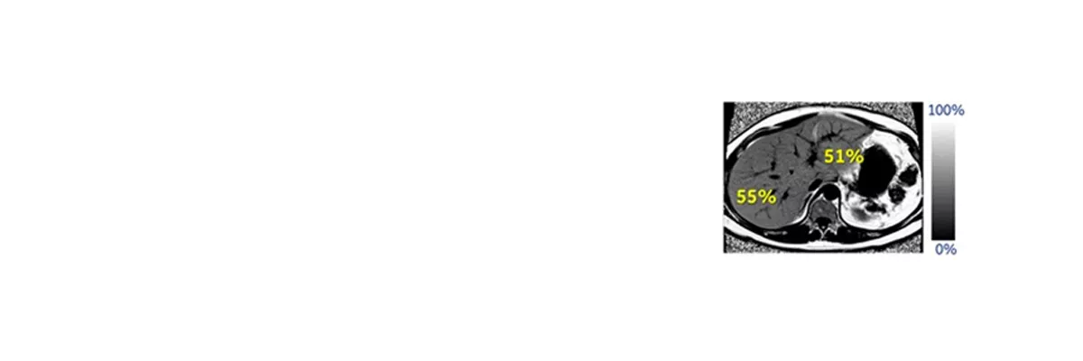 IDEAL-IQ-application-spotlight