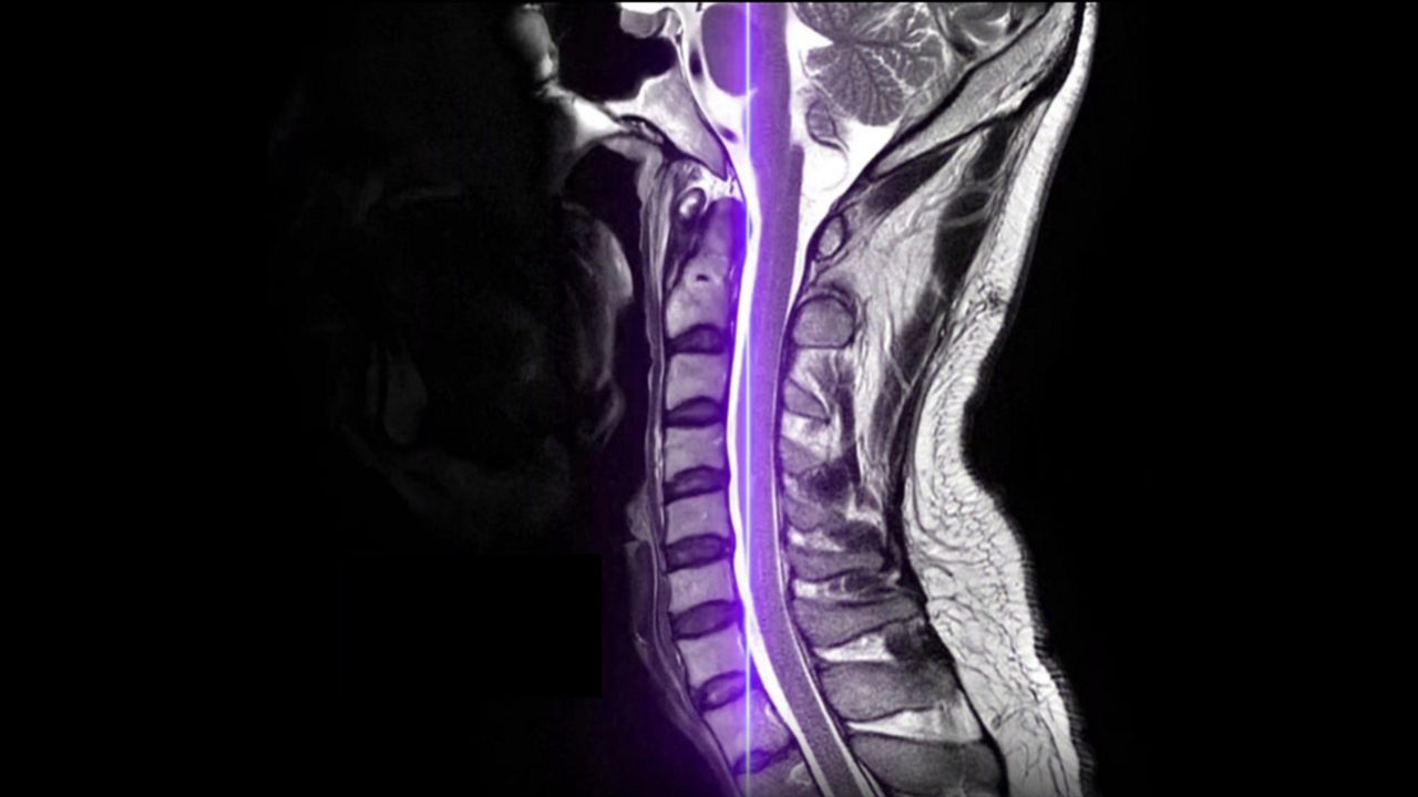 Image-2-air-recon-dl-ai-mri