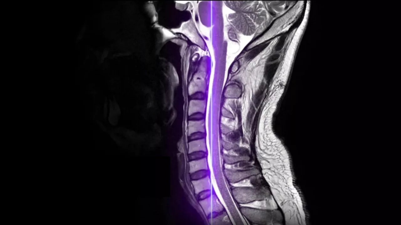 Image-2-air-recon-dl-ai-mri