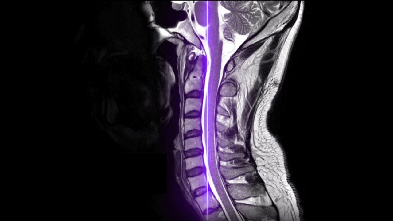 image-2-air-recon-dl-ai-mri-ci-en
