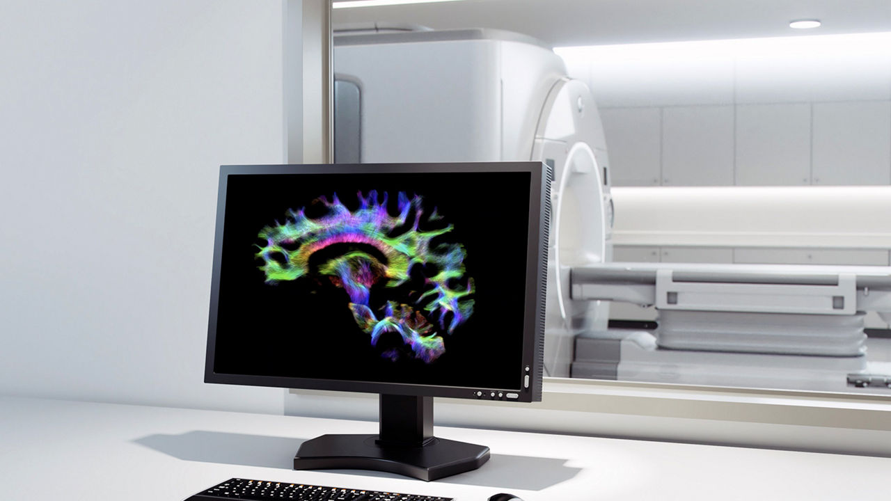 image-4-signa-vision-mri-groundbreaking-discoveries