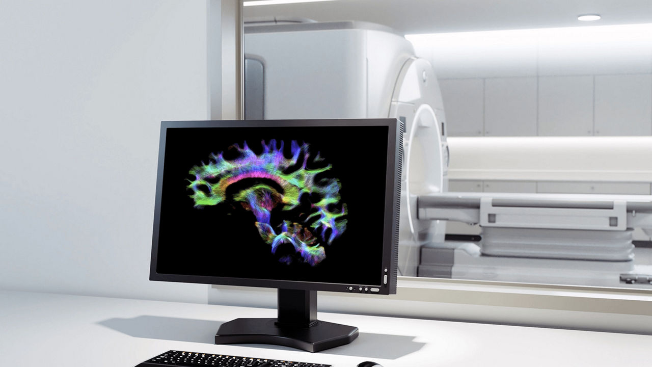 image-4-signa-vision-mri-groundbreaking-discoveries-ci-en