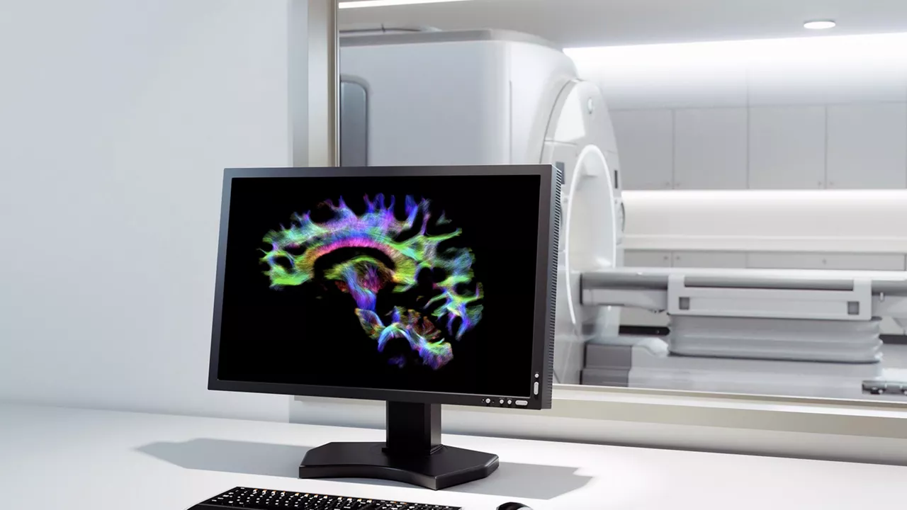 image-4-signa-vision-mri-groundbreaking-discoveries