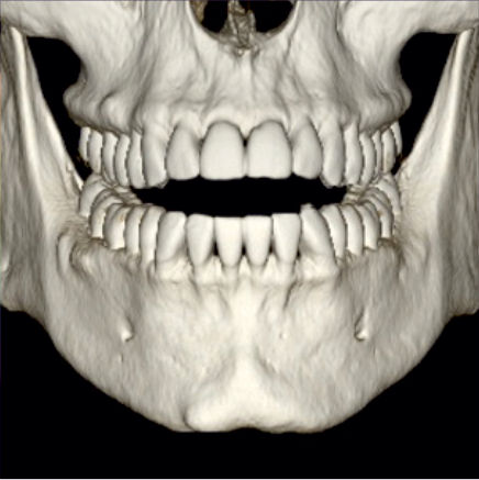 Image-53