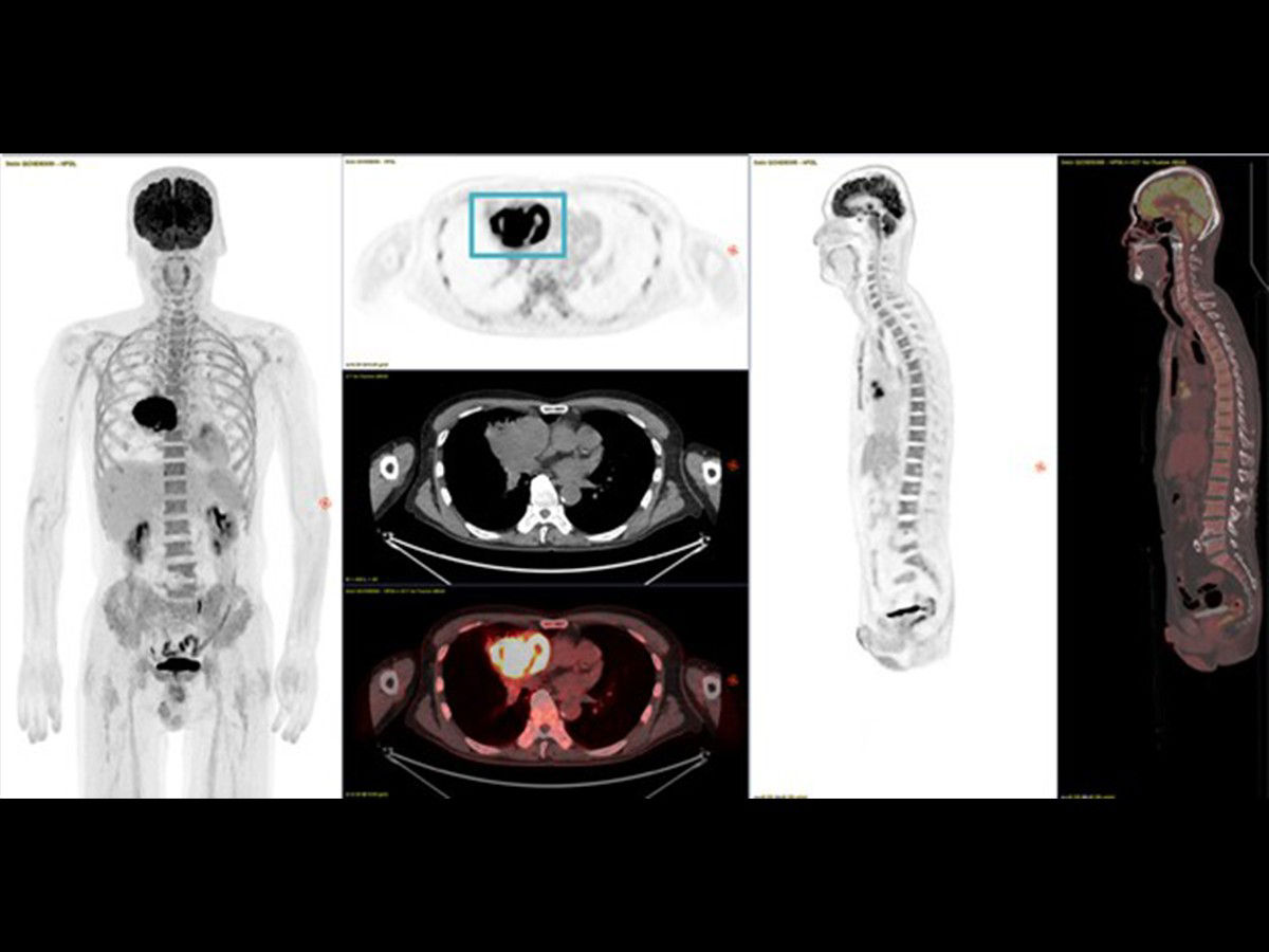 image-quality-in-molecular-imaging-is-enhancing-disease-detection-diagnosis-and-patient-care-banner-image-ba-en