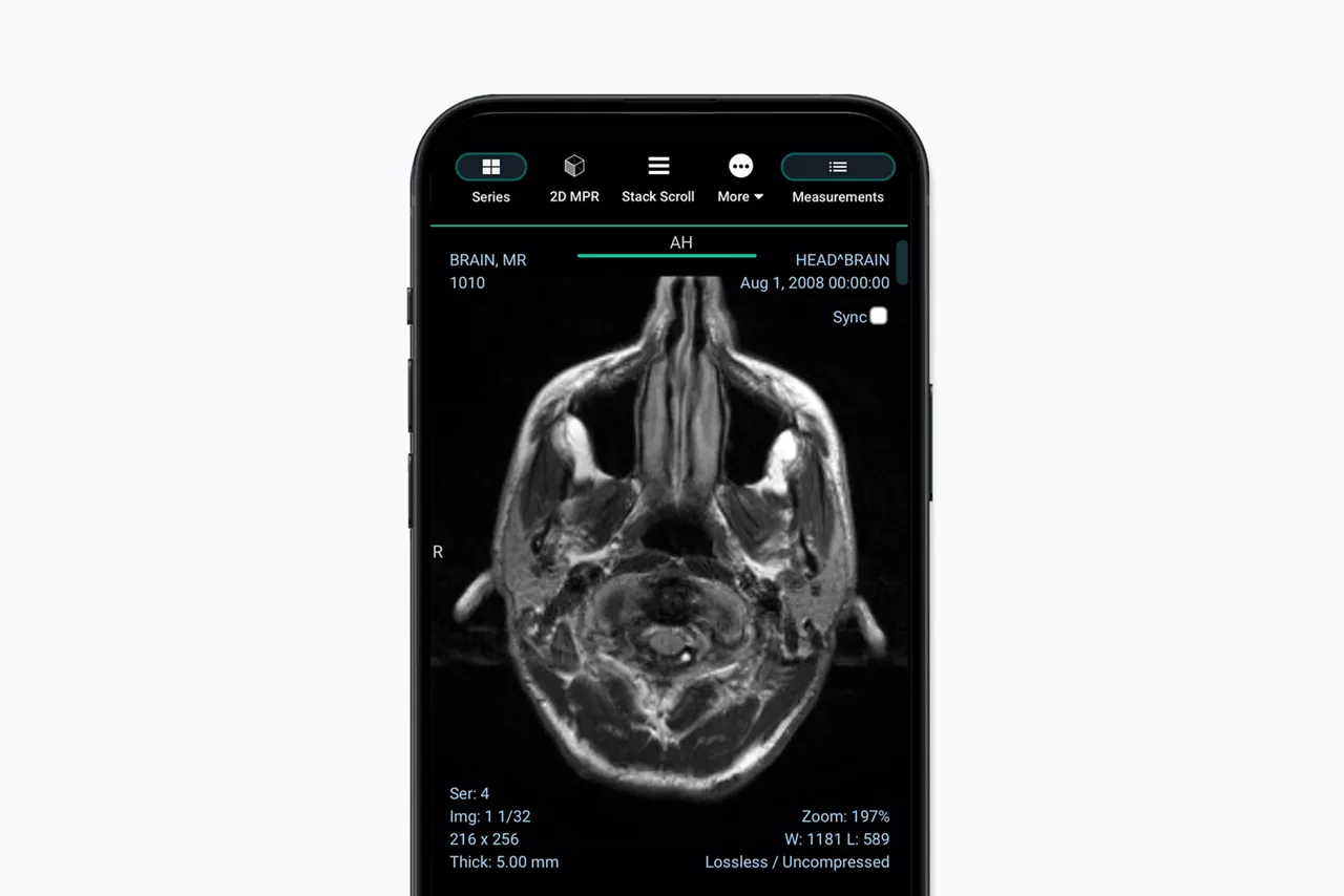 imaging-app-feature-hero-no1-1650x1100-ci-en
