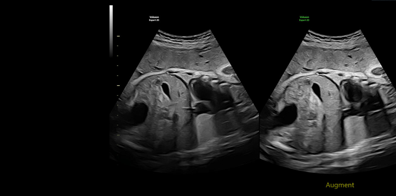 imaging-augment-voluson-expert-20