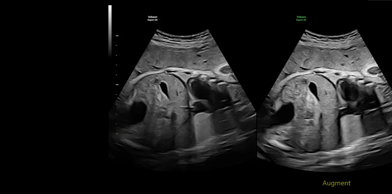 imaging-augment-voluson-expert-20