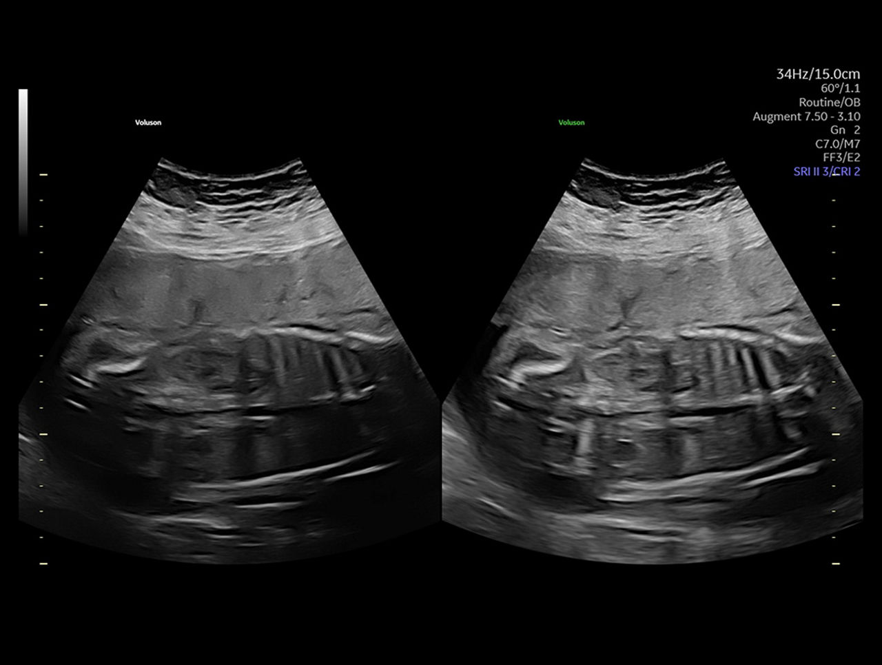 imaging-capabilities-augument-feature-ci-en