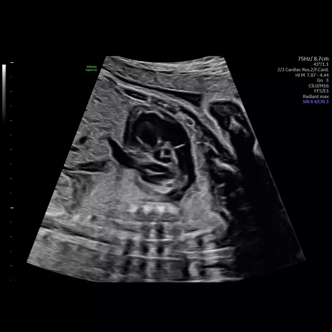 imaging-capabilities-on-augment-feature-v2-ci-en