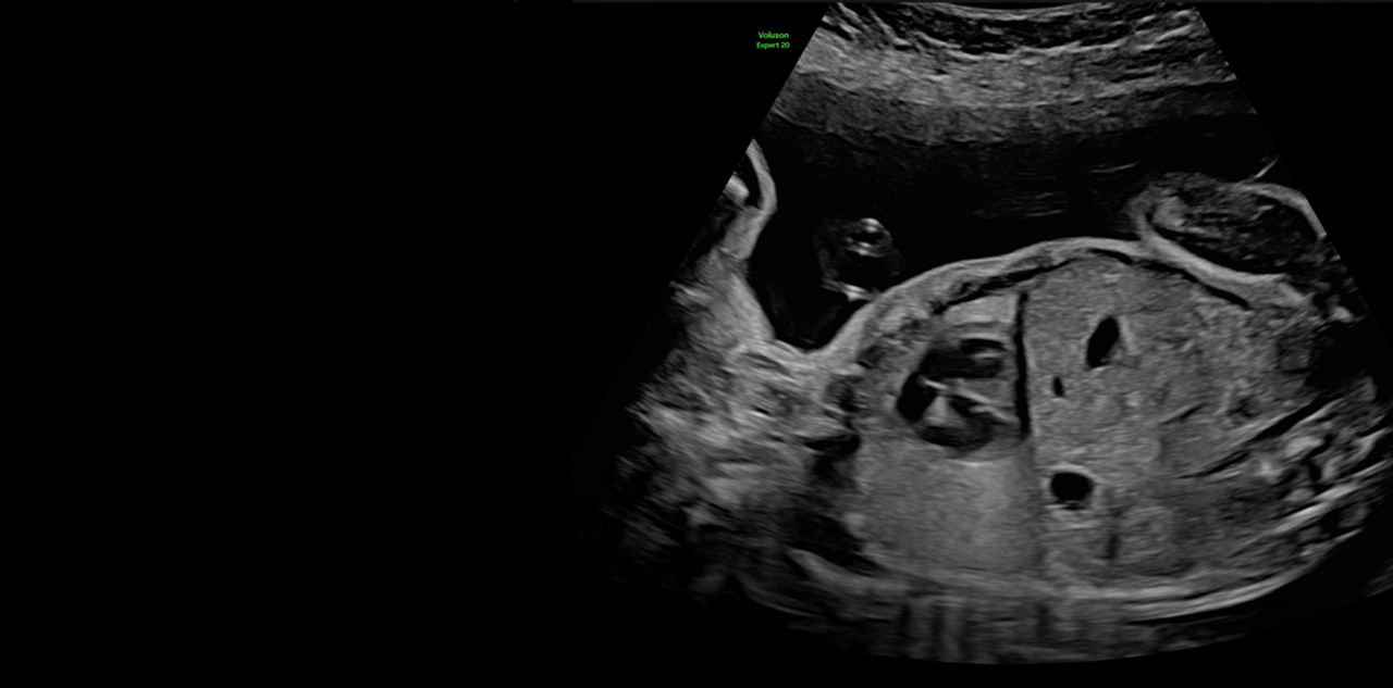 imaging-lyric-architecture-voluson-expert-20