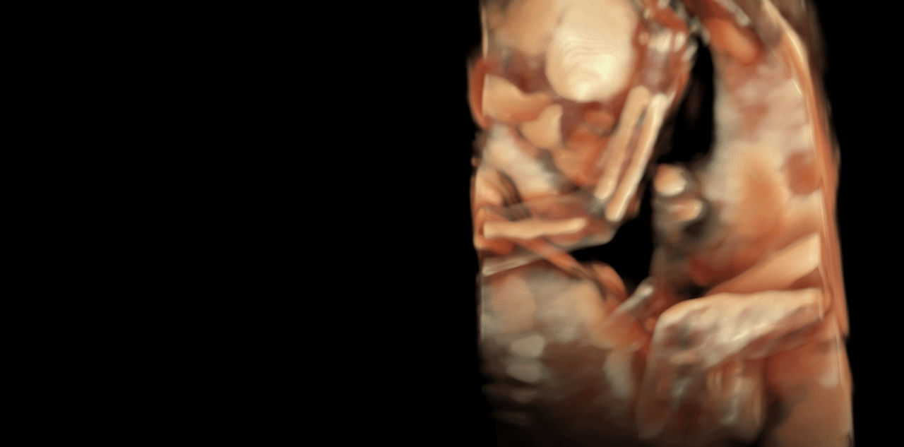 imaging-voluson-expert-20