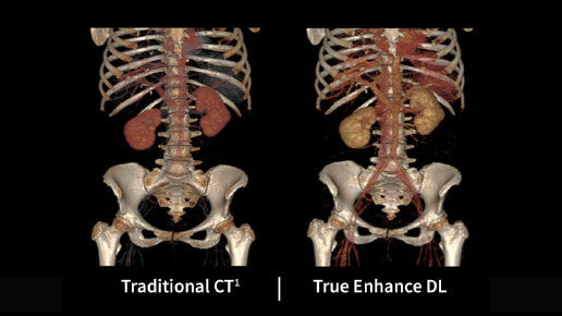 Imaging02FeatureCard516x290