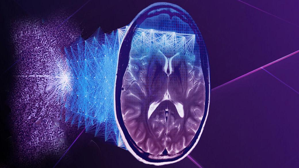 Imaging Lifecycle-Management-Digital-Solutions-RelatedContent-MR