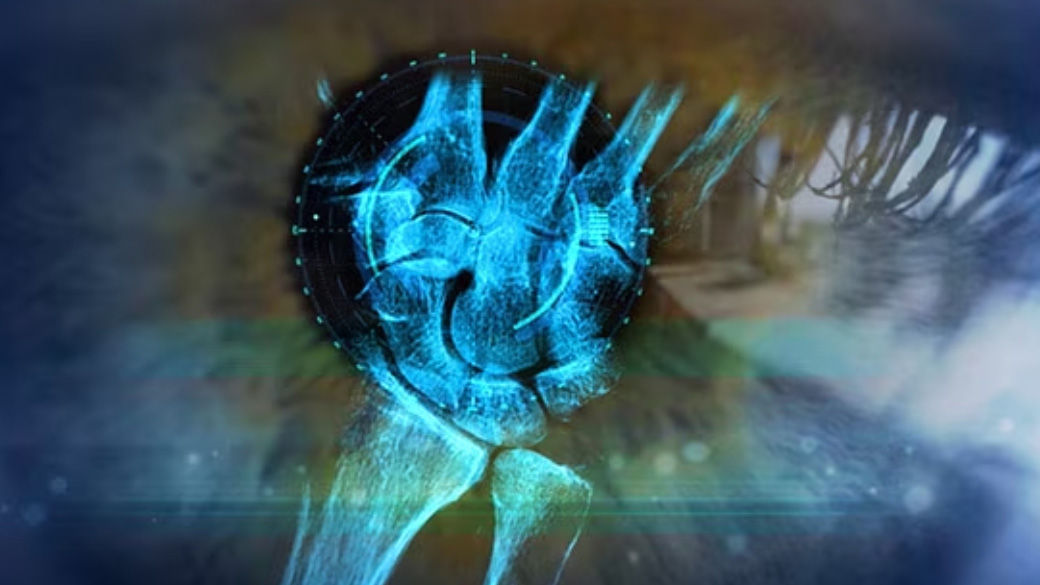 Imaging Lifecycle-Management-Digital-Solutions-RelatedContent-Xray