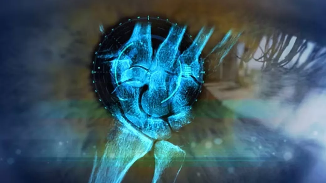 Imaging Lifecycle-Management-Digital-Solutions-RelatedContent-Xray