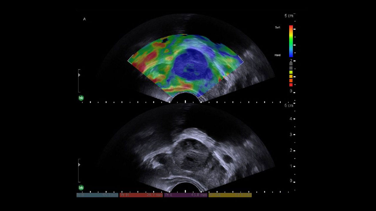 img-1-sub-specialty-urology-desktop