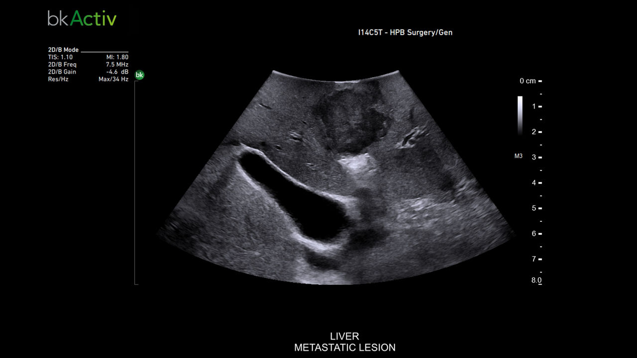 img-2-sub-specialty-general-surgery-desktop