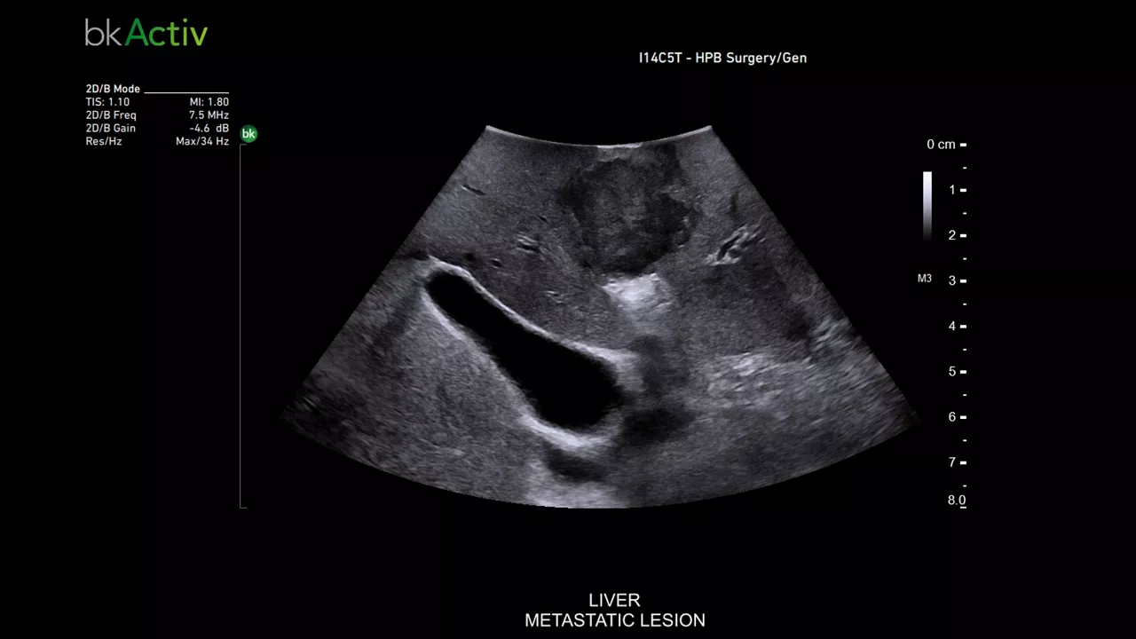 img-2-sub-specialty-general-surgery-desktop