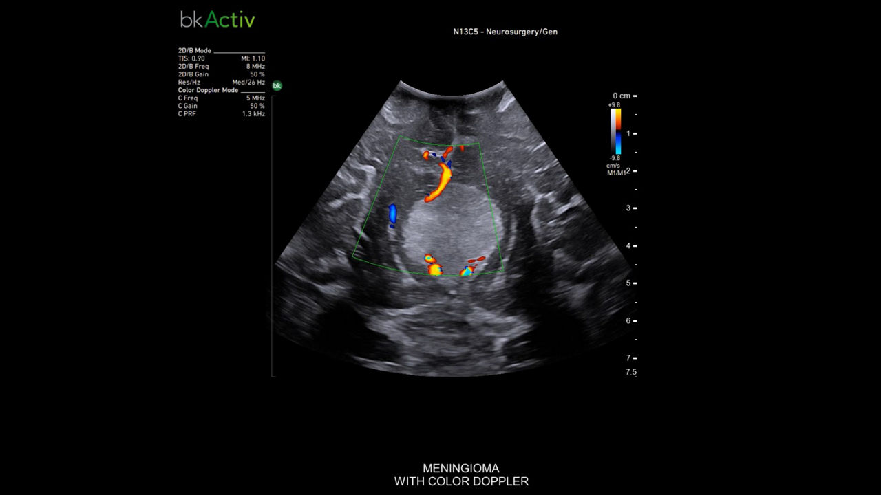 img-3-sub-specialty-neurosurgery-and-spine-mobile