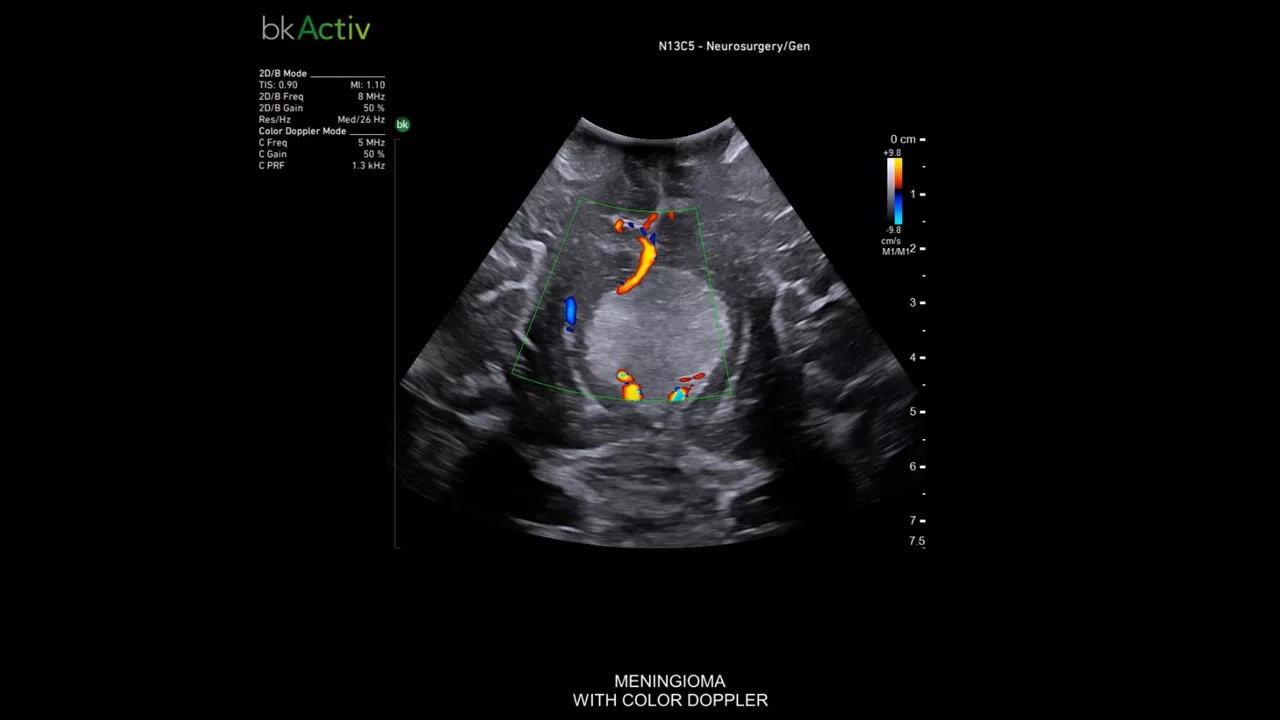img-3-sub-specialty-neurosurgery-and-spine-mobile