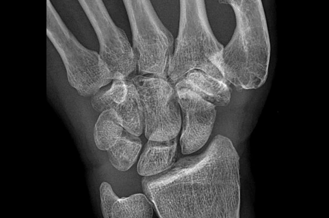 improve-diagnostics-desktop