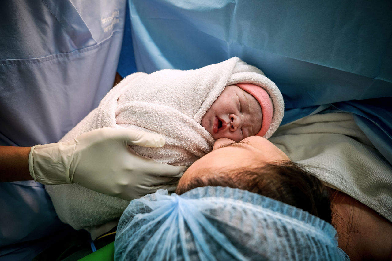 Crying infant being shown to their mother in an operating room.