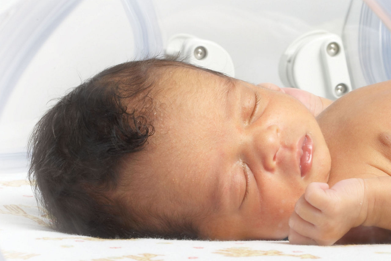 Close-up of an infant in a care station, focusing on their face.