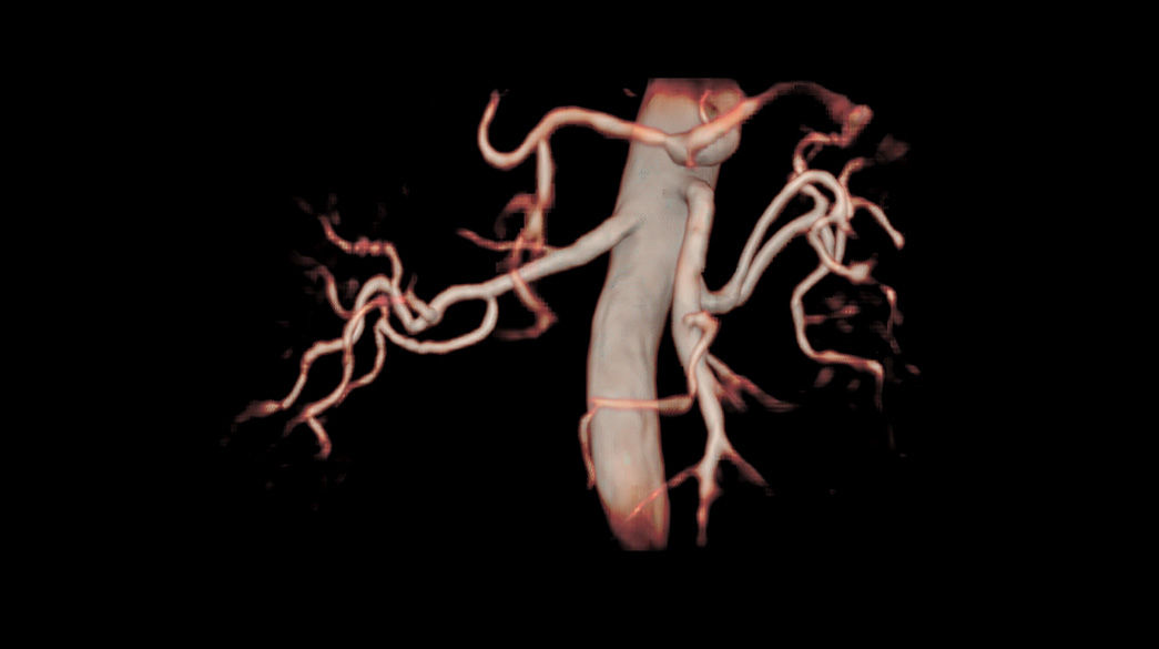 Inhance-Suite1040-x-585