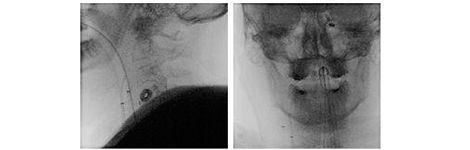 630benefits_Off-iosocenter