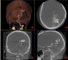 Innova3DInnovaCTOptimaIGS3