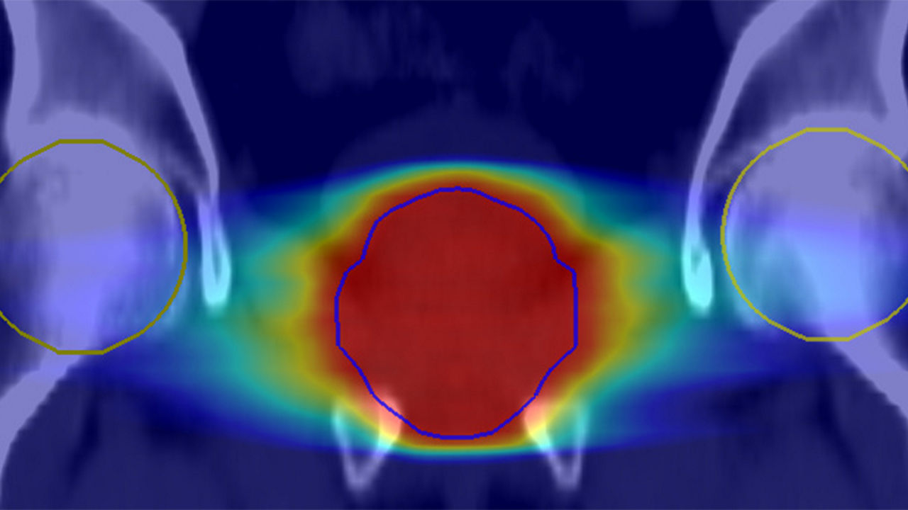 Image of an MRI planner scan.