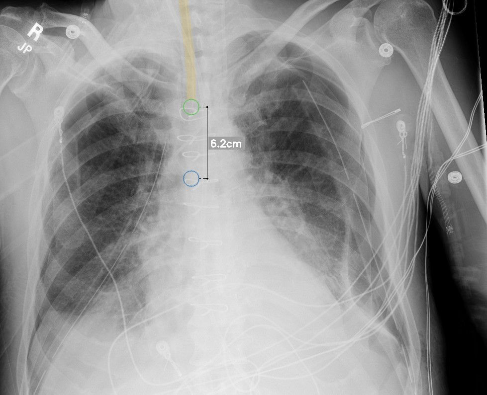 intelligent-xray-efficiencies