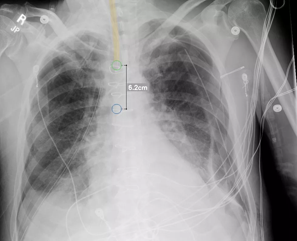 intelligent-xray-efficiencies