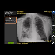 IntelligentFieldView235x235