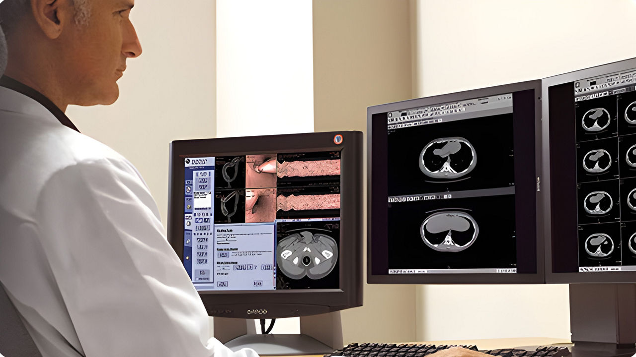 <p>Radiology PACS, Workstations, Mammo &amp; RIS IHE Statements</p>
