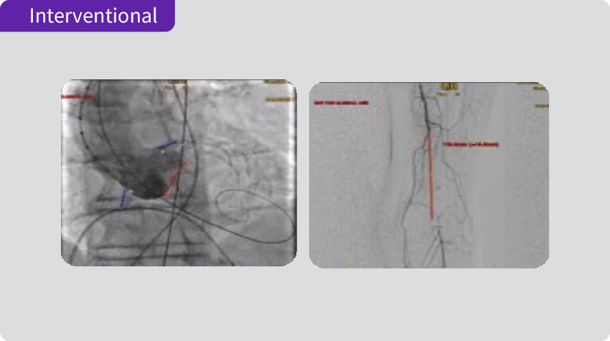 Interventional - Digital Pen