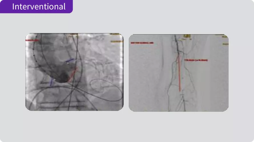 Interventional - Digital Pen