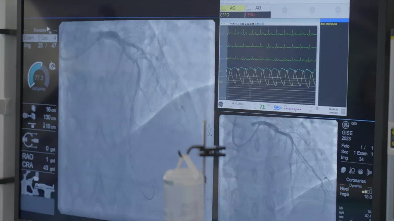 interventional-cardiologists-share-their-experience-with-3dstent