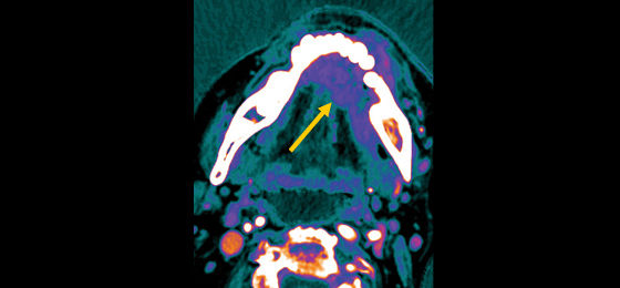 Iodine color map 560x260