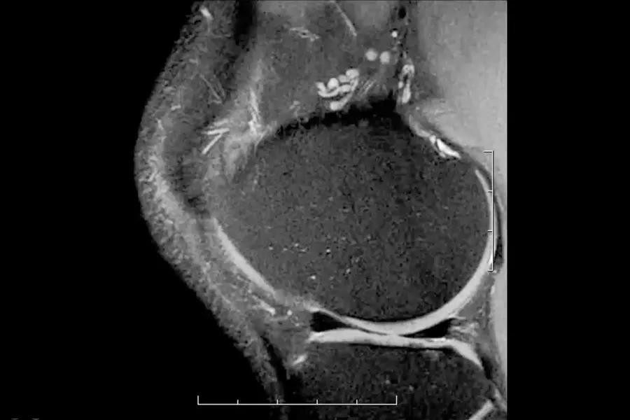 Isotropic-3D-imaging