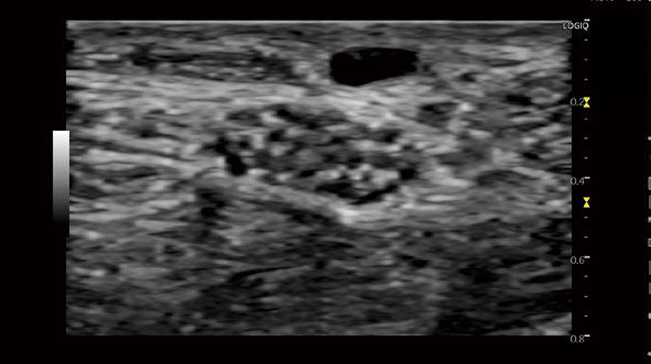 L10-22-RS_