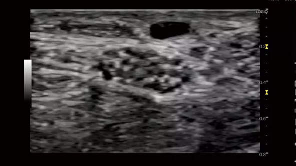 L10-22-RS_