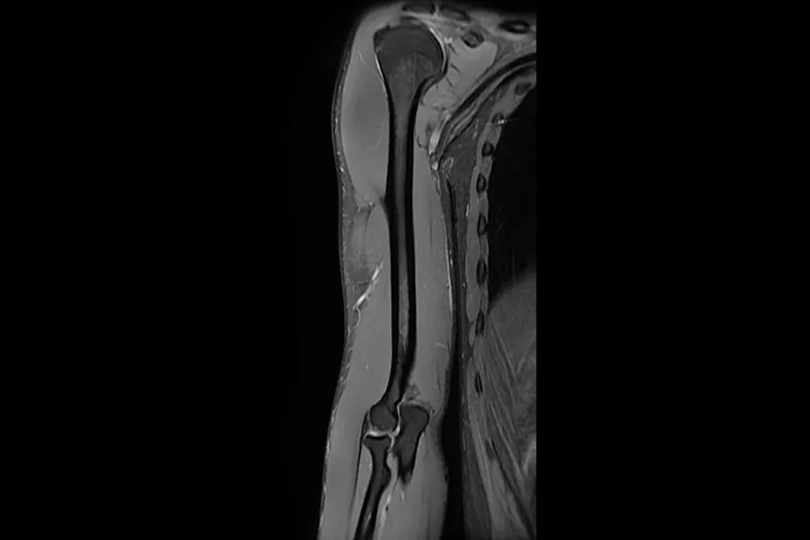 Characterizingcartilagebeforeandaftersurgery
