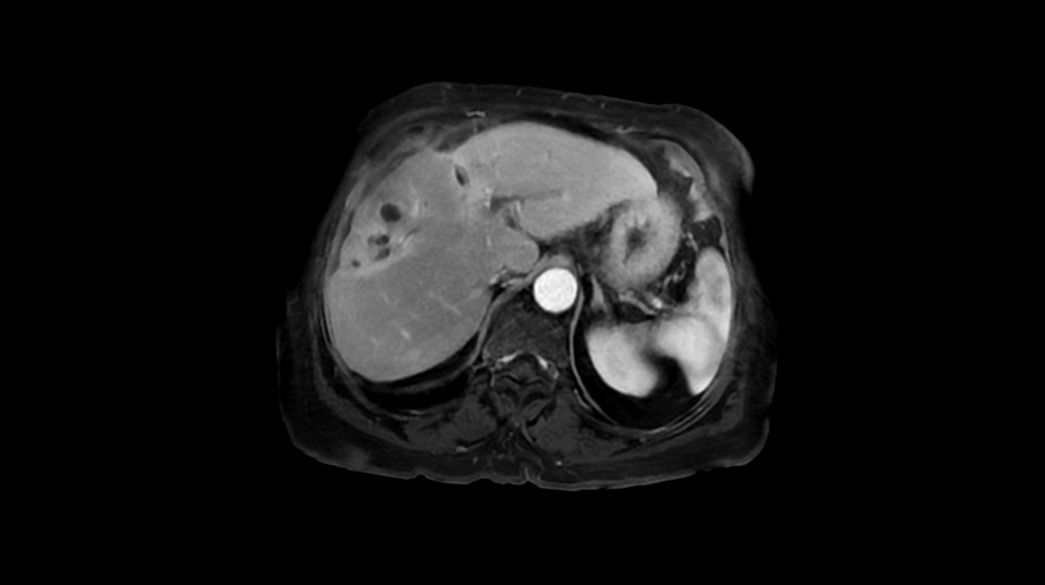 <p>LAVA Star &amp; DISCO Star</p>
