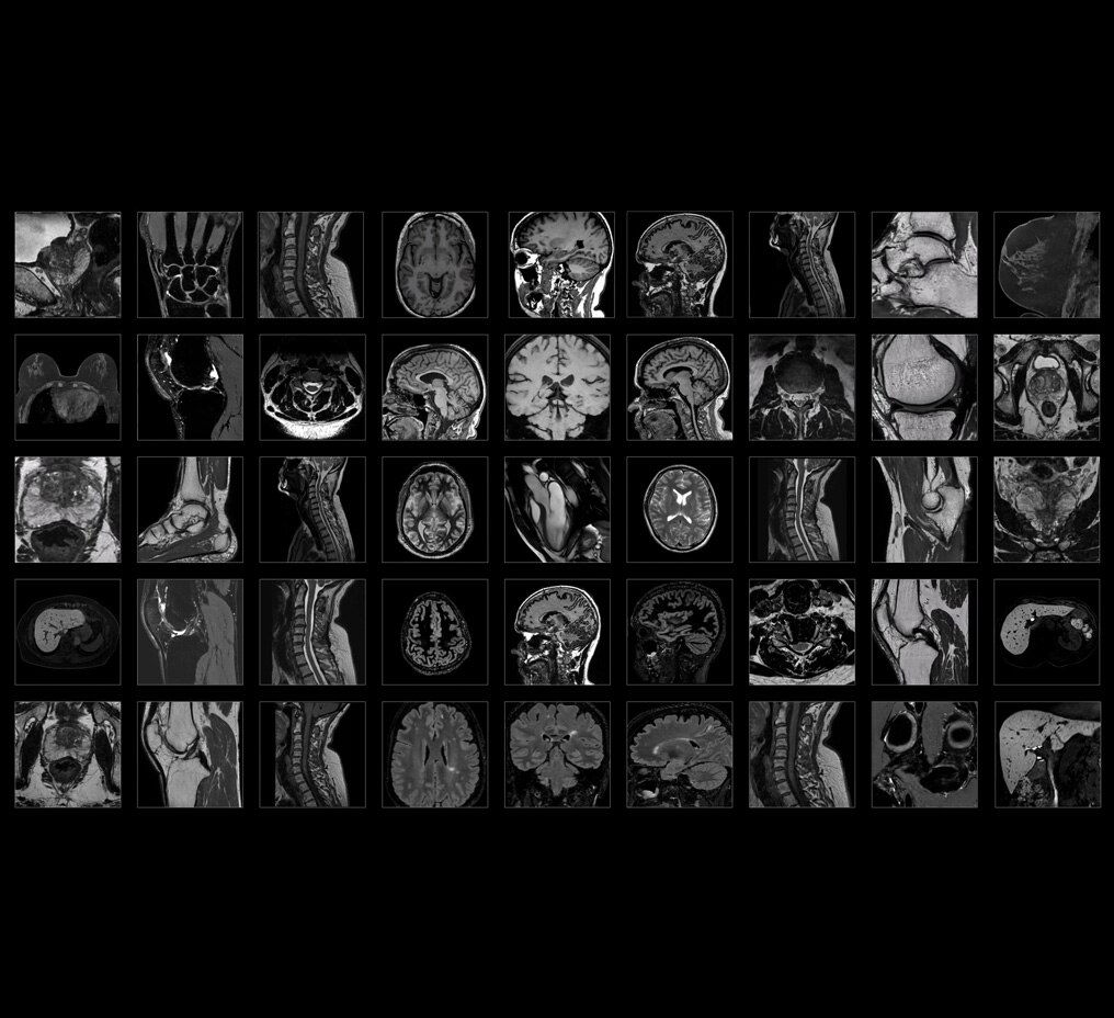 life-speed-imaging-has-expanded-into-3d-with-sonic-dl-ci-en