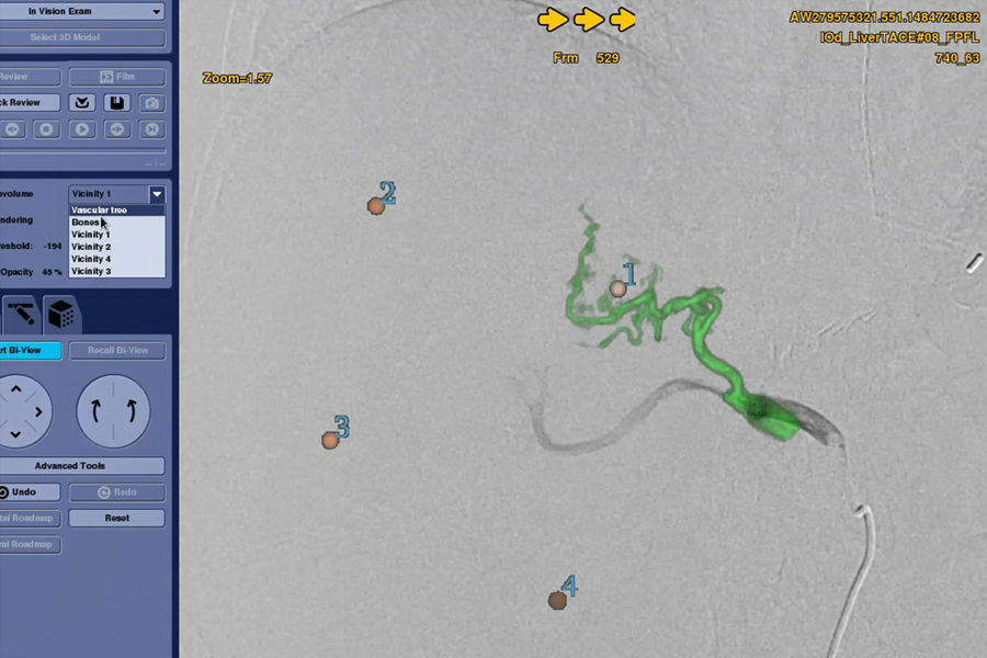 liver-assist-virtual-parenchyma-guide